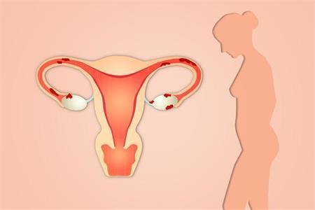 兴义妇女子宫内膜炎对生孩子有影响吗